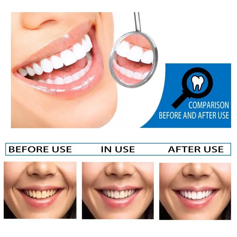 Sparkling Smile Whitening Serum