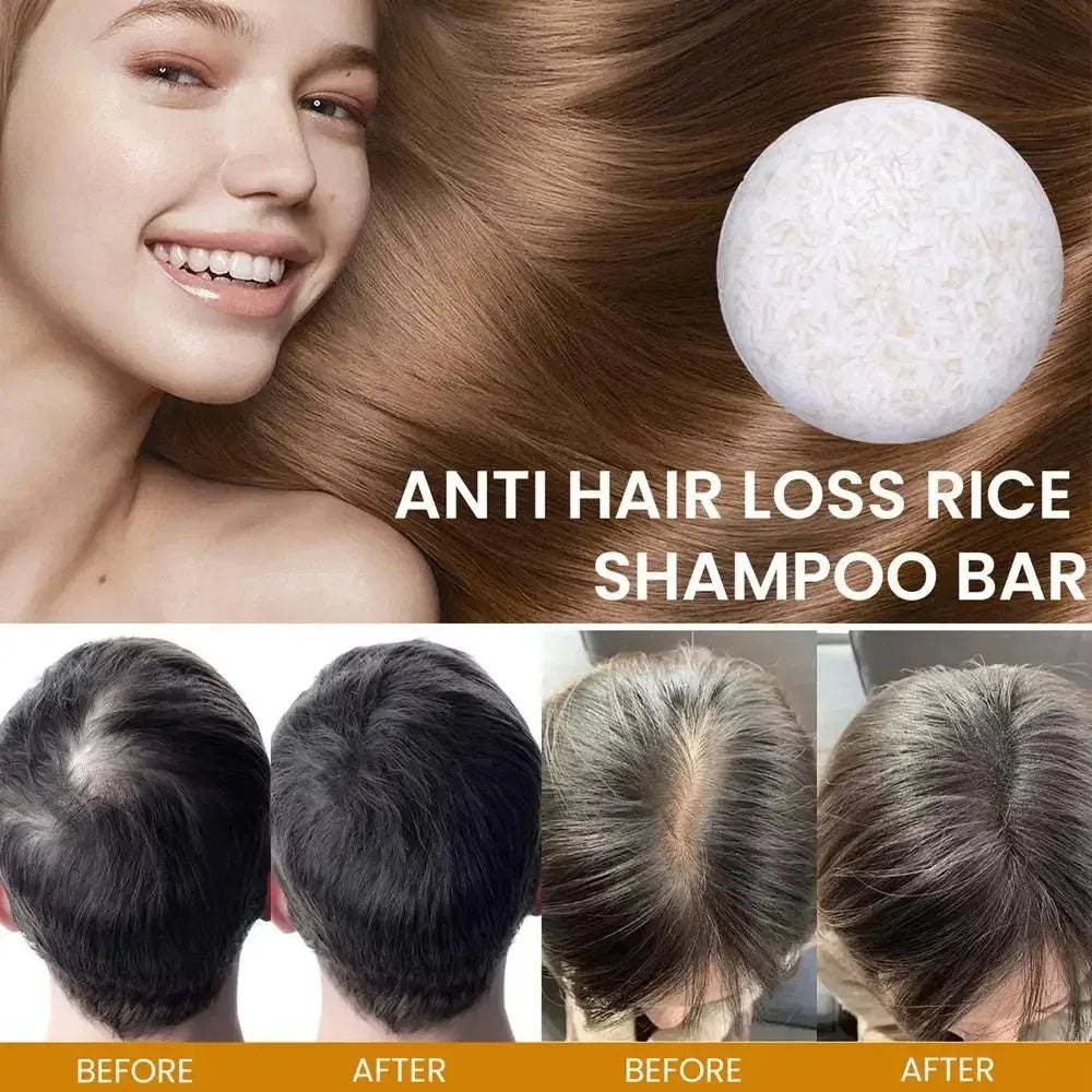 Rice Water Hair Growth Bar